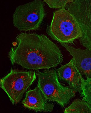 Mikroskopische Ansicht menschlicher Eierstockkrebszellen – durch die Immunfluoreszenzfärbung erscheinen Zellkerne blau und das Zellskelett grün. © Uniklinikum Dresden/Klinik für Frauenheilkunde und Geburtshilfe