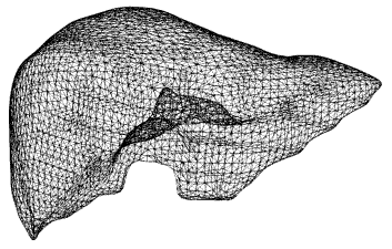 Bild_Remeshing for Soft Tissue.png