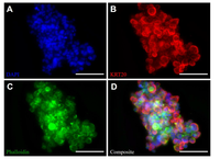 Warum erkranken Frauen und Männer unterschiedlich an Darmkrebs – und was bedeutet das für zukünftige Therapien?