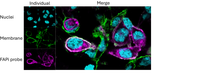 Precise Sarcoma Therapy: Dresden Research Team Develops Image-Guided Molecular Treatment