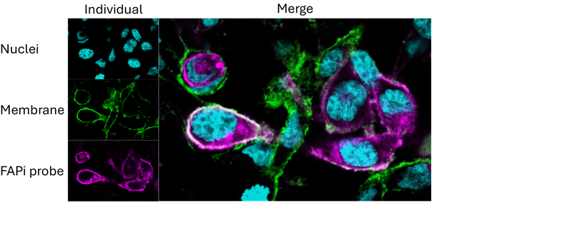 Precise Sarcoma Therapy: Dresden Research Team Develops Image-Guided Molecular Treatment