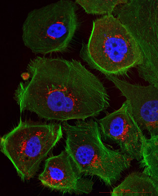 Mikroskopische Ansicht menschlicher Eierstockkrebszellen – durch die Immunfluoreszenzfärbung erscheinen Zellkerne blau und das Zellskelett grün. © Uniklinikum Dresden/Klinik für Frauenheilkunde und Geburtshilfe