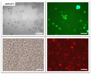Leukämie-Zellen, welche das grün-markierte Cas9 für die CRISPR-Gen Schere bilden, und die rot markierte sgRNA, um die Cas9-Gen-Schere zu den richtigen Genen zu leiten. © NCT/UCC/TMO