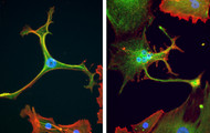 Im Labor kultivierte Zellen einer Sarkomkrebszelllinie. Quelle: Charles S. Umbaugh, Fröhling Lab/NCT Heidelberg