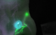 Innovative fluorescence imaging reveals the tumor (blue), lymphatic vessels (green) and blood vessels (magenta). © Dr. Mara Saccomano, Helmholtz Munich