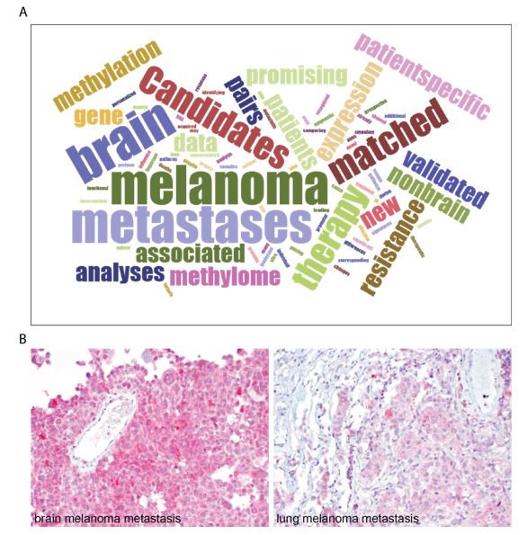 Wordcloud copyright: Copyright Jason Davies | Privacy Policy. The generated word clouds may be used for any purpose. Immunohistochemical stainings copyright: To the project leaders and cooperation partners (Meier/Muders/Seifert/Westphal/Meinhardt) of the N