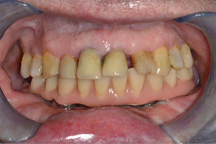 Oral Surgery3